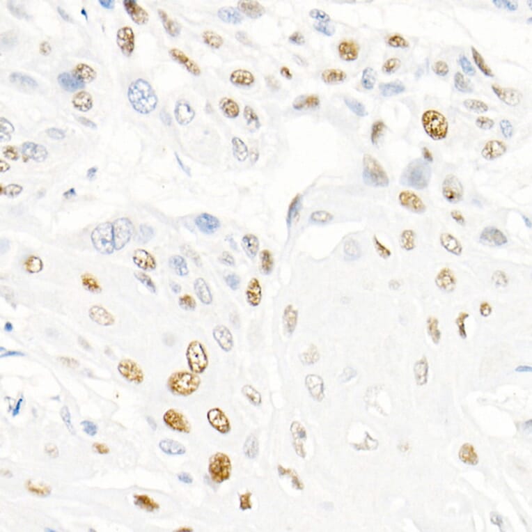 Immunohistochemistry - Anti-Cyclin E1 Antibody [ARC51383] (A305272) - Antibodies.com