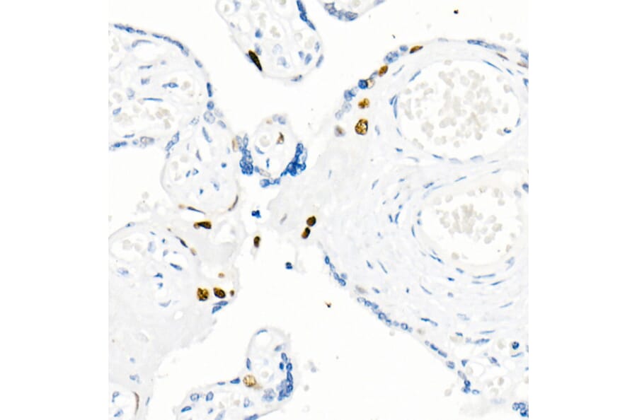 Immunohistochemistry - Anti-Cyclin E1 Antibody [ARC51383] (A305272) - Antibodies.com