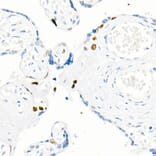 Immunohistochemistry - Anti-Cyclin E1 Antibody [ARC51383] (A305272) - Antibodies.com