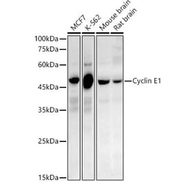 Western Blot - Anti-Cyclin E1 Antibody [ARC51384 + ARC51385] (A305274) - Antibodies.com