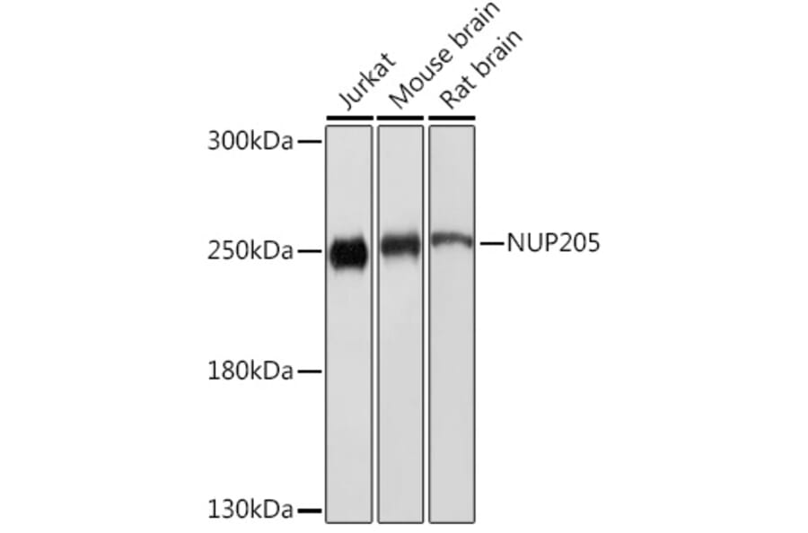 Western Blot - Anti-NUP205 Antibody (A305275) - Antibodies.com