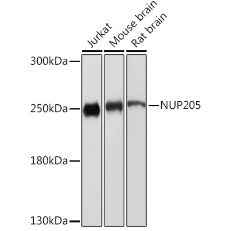 Western Blot - Anti-NUP205 Antibody (A305275) - Antibodies.com