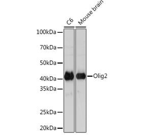 Western Blot - Anti-Olig2 Antibody [ARC1032] (A305277) - Antibodies.com