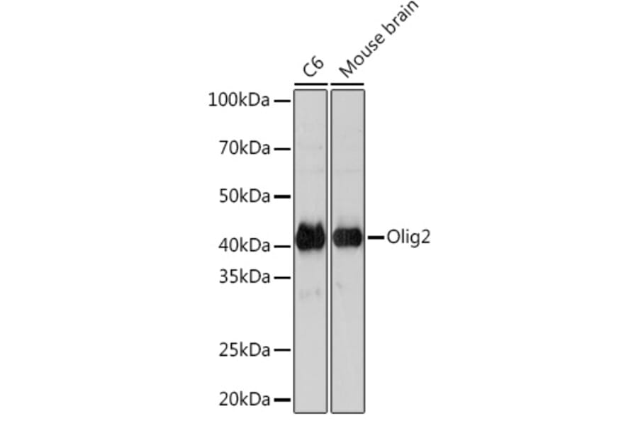 Western Blot - Anti-Olig2 Antibody [ARC1032] (A305277) - Antibodies.com