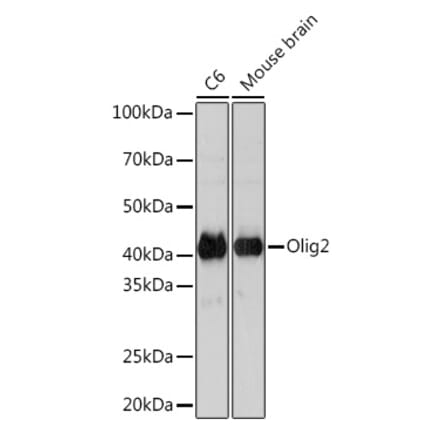 Western Blot - Anti-Olig2 Antibody [ARC1032] (A305277) - Antibodies.com