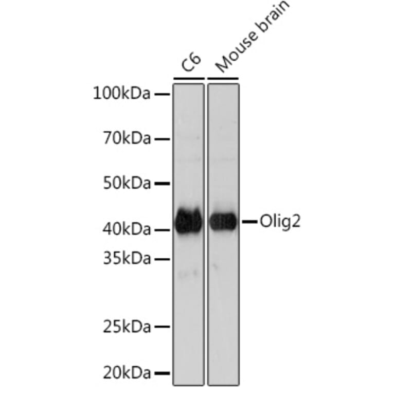 Western Blot - Anti-Olig2 Antibody [ARC1032] (A305277) - Antibodies.com
