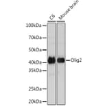 Western Blot - Anti-Olig2 Antibody [ARC1032] (A305277) - Antibodies.com