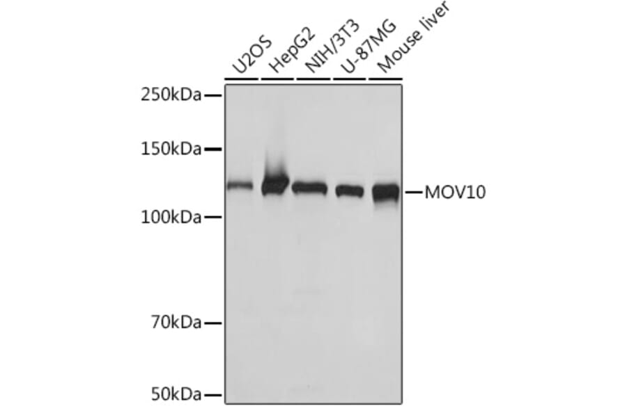 Western Blot - Anti-Mov10 Antibody [ARC1817] (A305278) - Antibodies.com