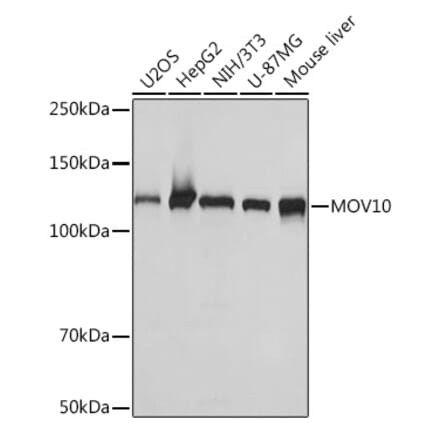 Western Blot - Anti-Mov10 Antibody [ARC1817] (A305278) - Antibodies.com