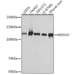 Western Blot - Anti-Mov10 Antibody [ARC1817] (A305278) - Antibodies.com