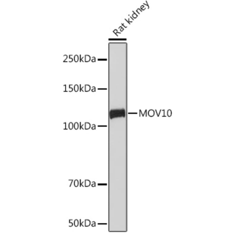 Western Blot - Anti-Mov10 Antibody [ARC1817] (A305278) - Antibodies.com