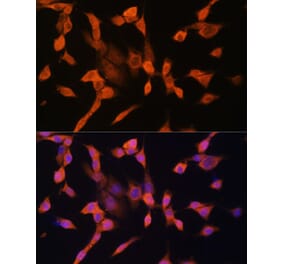 Immunofluorescence - Anti-PRKAR1A Antibody (A305279) - Antibodies.com