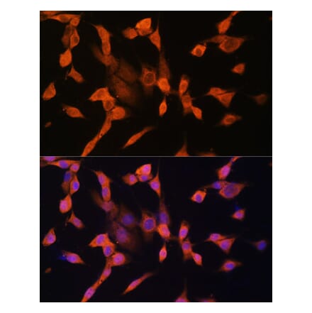 Immunofluorescence - Anti-PRKAR1A Antibody (A305279) - Antibodies.com