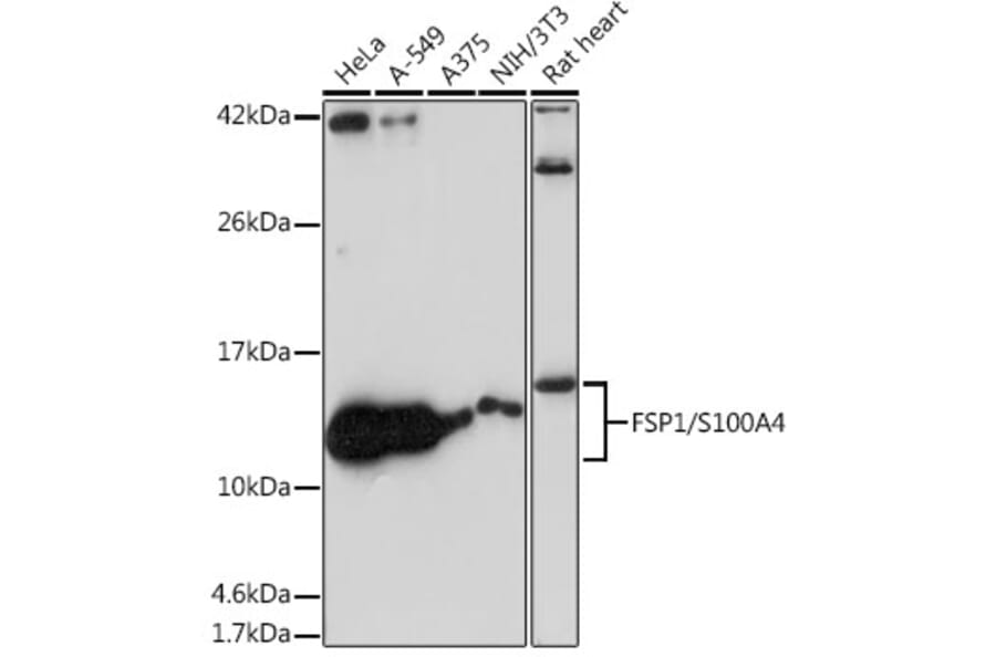 Western Blot - Anti-S100A4 Antibody [ARC0475] (A305282) - Antibodies.com