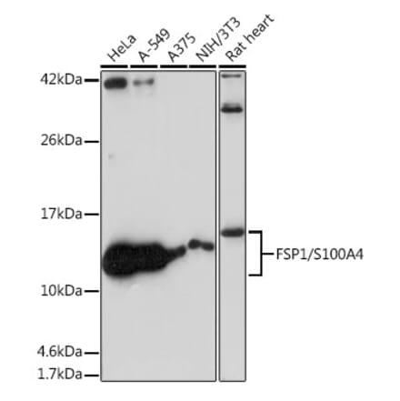 Western Blot - Anti-S100A4 Antibody [ARC0475] (A305282) - Antibodies.com