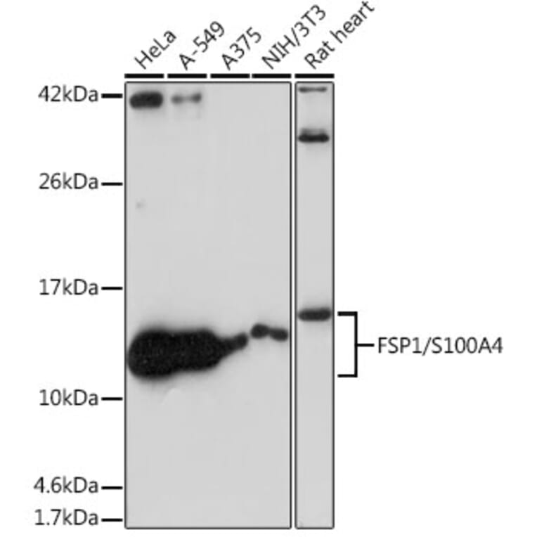 Western Blot - Anti-S100A4 Antibody [ARC0475] (A305282) - Antibodies.com