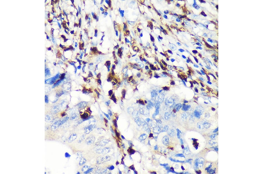 Immunohistochemistry - Anti-S100A4 Antibody [ARC0475] (A305282) - Antibodies.com