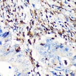 Immunohistochemistry - Anti-S100A4 Antibody [ARC0475] (A305282) - Antibodies.com