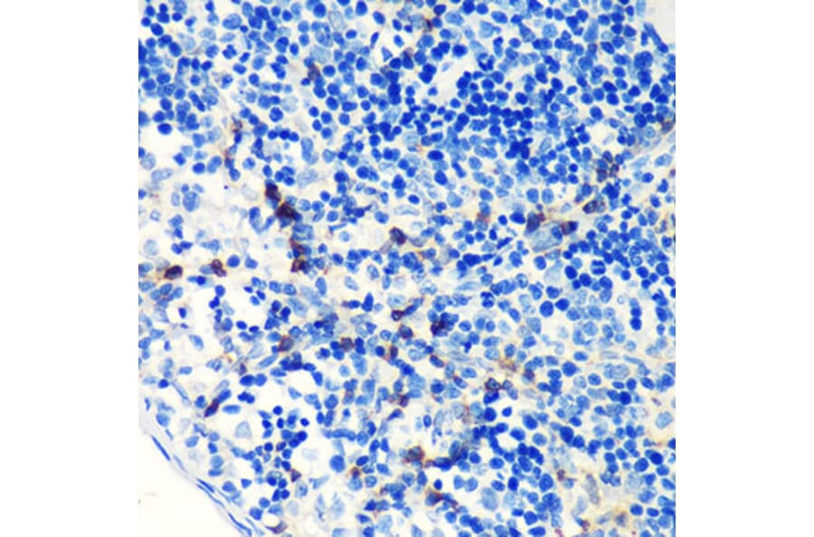 Immunohistochemistry - Anti-S100A4 Antibody [ARC0475] (A305282) - Antibodies.com