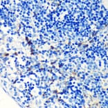 Immunohistochemistry - Anti-S100A4 Antibody [ARC0475] (A305282) - Antibodies.com