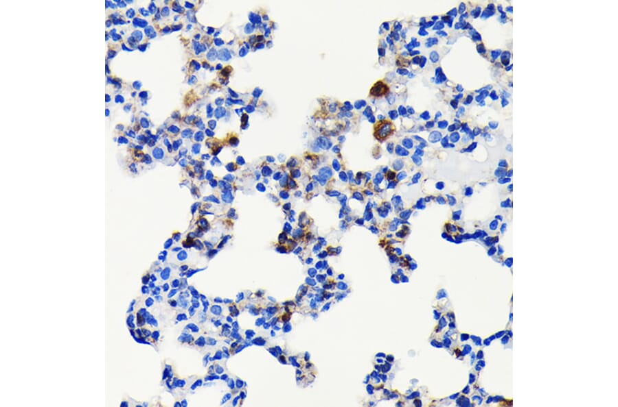 Immunohistochemistry - Anti-S100A4 Antibody [ARC0475] (A305282) - Antibodies.com