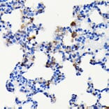 Immunohistochemistry - Anti-S100A4 Antibody [ARC0475] (A305282) - Antibodies.com