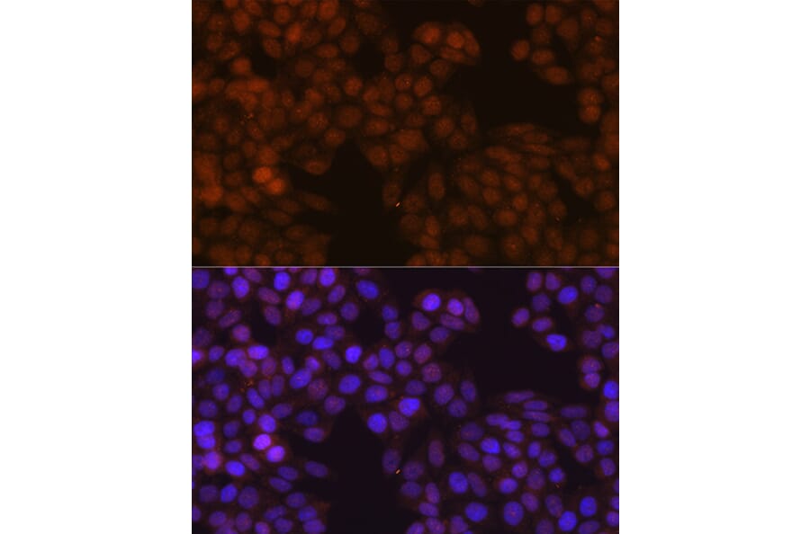 Immunofluorescence - Anti-S100A4 Antibody [ARC0475] (A305282) - Antibodies.com