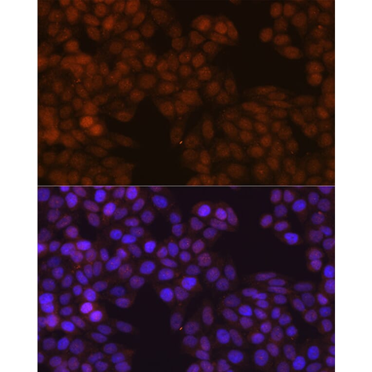 Immunofluorescence - Anti-S100A4 Antibody [ARC0475] (A305282) - Antibodies.com