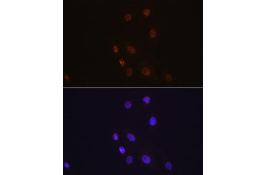 Immunofluorescence - Anti-S100A4 Antibody [ARC0475] (A305282) - Antibodies.com