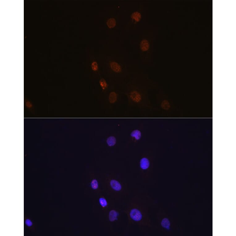 Immunofluorescence - Anti-S100A4 Antibody [ARC0475] (A305282) - Antibodies.com