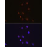 Immunofluorescence - Anti-S100A4 Antibody [ARC0475] (A305282) - Antibodies.com