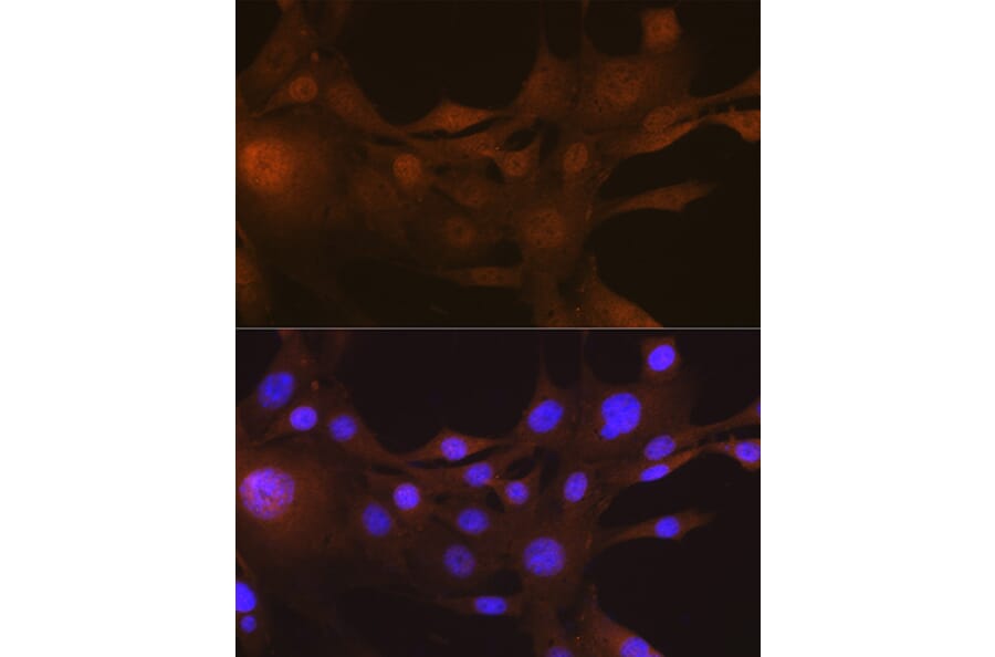 Immunofluorescence - Anti-S100A4 Antibody [ARC0475] (A305282) - Antibodies.com