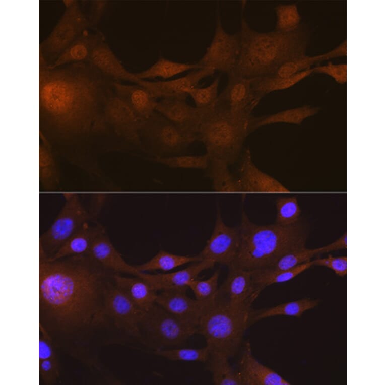 Immunofluorescence - Anti-S100A4 Antibody [ARC0475] (A305282) - Antibodies.com