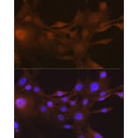 Immunofluorescence - Anti-S100A4 Antibody [ARC0475] (A305282) - Antibodies.com