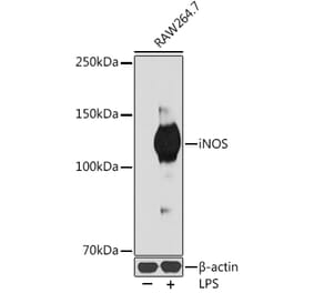 Western Blot - Anti-iNOS Antibody [ARC0832] (A305283) - Antibodies.com