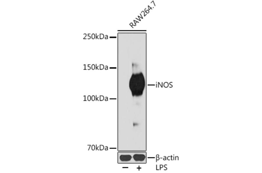 Western Blot - Anti-iNOS Antibody [ARC0832] (A305283) - Antibodies.com