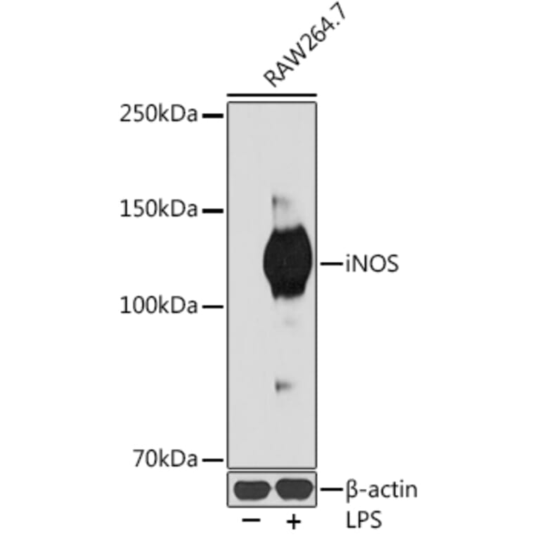 Western Blot - Anti-iNOS Antibody [ARC0832] (A305283) - Antibodies.com