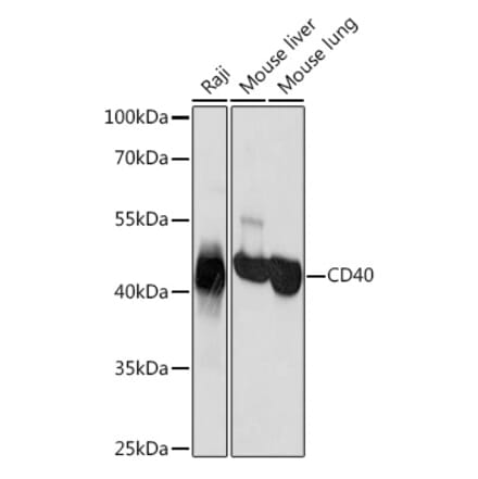 Western Blot - Anti-CD40 Antibody (A305284) - Antibodies.com