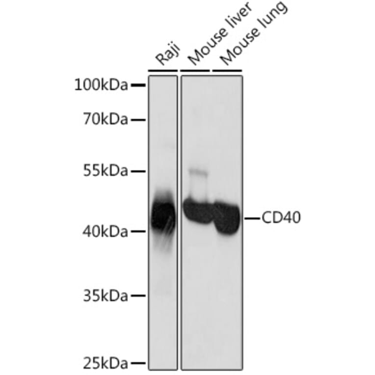 Western Blot - Anti-CD40 Antibody (A305284) - Antibodies.com