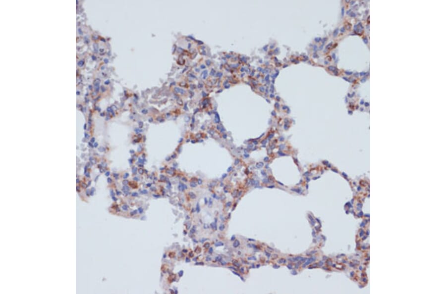 Immunohistochemistry - Anti-CD40 Antibody (A305284) - Antibodies.com