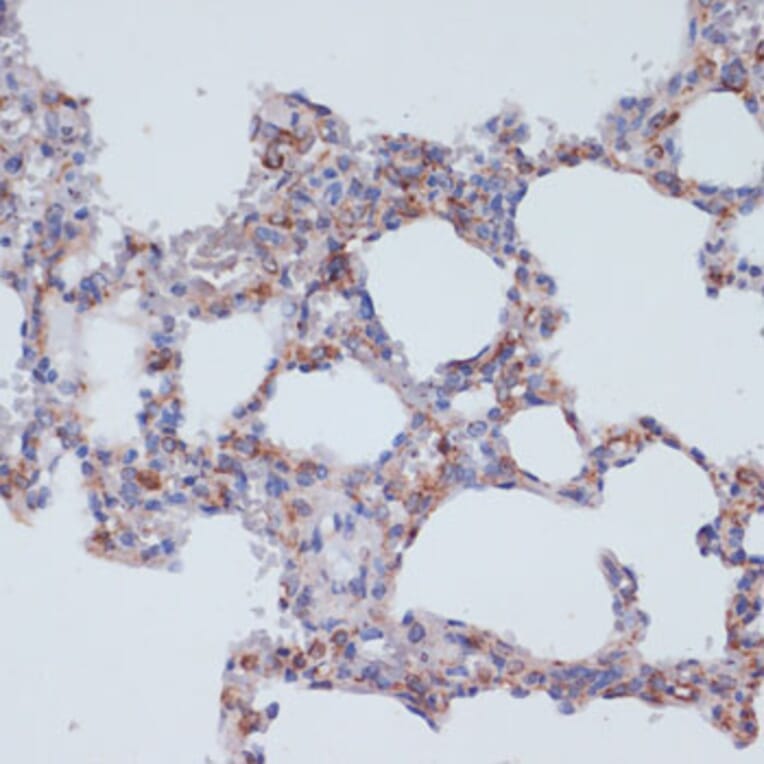 Immunohistochemistry - Anti-CD40 Antibody (A305284) - Antibodies.com