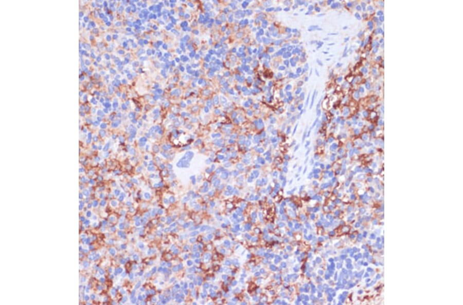 Immunohistochemistry - Anti-CD40 Antibody (A305284) - Antibodies.com