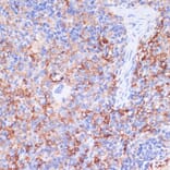 Immunohistochemistry - Anti-CD40 Antibody (A305284) - Antibodies.com