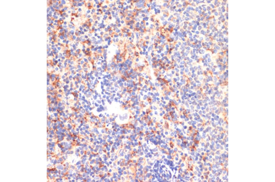 Immunohistochemistry - Anti-CD40 Antibody (A305284) - Antibodies.com
