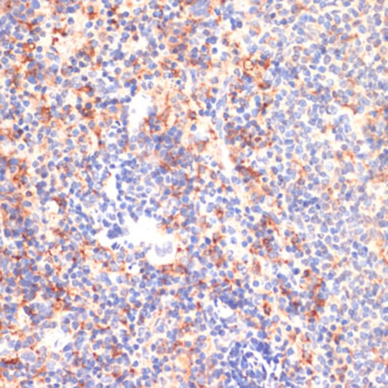 Immunohistochemistry - Anti-CD40 Antibody (A305284) - Antibodies.com