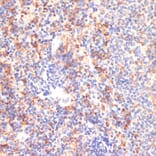 Immunohistochemistry - Anti-CD40 Antibody (A305284) - Antibodies.com