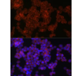 Immunofluorescence - Anti-Axin 2 Antibody (A305285) - Antibodies.com