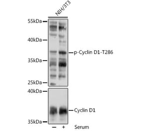 Western Blot - Anti-Cyclin D1 (phospho Thr286) Antibody (A305286) - Antibodies.com