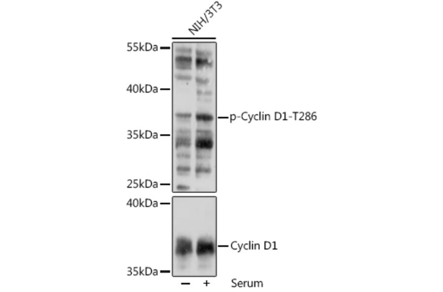 Western Blot - Anti-Cyclin D1 (phospho Thr286) Antibody (A305286) - Antibodies.com