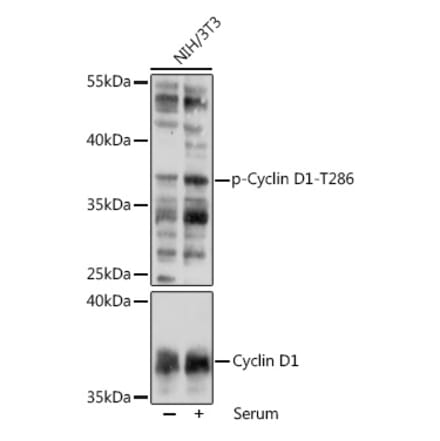 Western Blot - Anti-Cyclin D1 (phospho Thr286) Antibody (A305286) - Antibodies.com